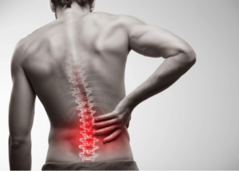 Lumbar Radiculopathy