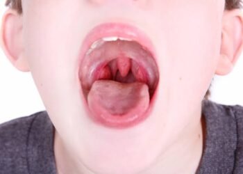 Can Tonsils Grow Back After Being Removed? – Tymoff A Comprehensive Analysis
