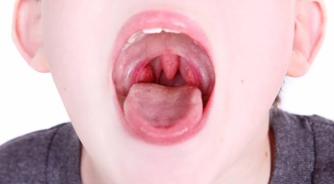 Can Tonsils Grow Back After Being Removed? – Tymoff A Comprehensive Analysis