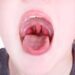 Can Tonsils Grow Back After Being Removed? – Tymoff A Comprehensive Analysis