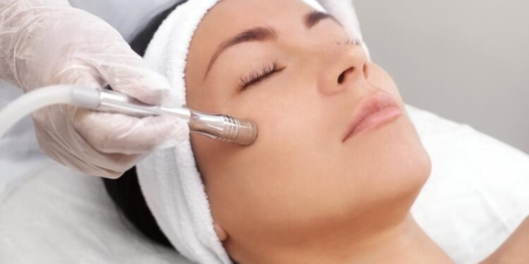 Microdermabrasion