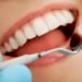 A Healthy Mouth Starts with You: Tips for Maintaining Optimal Oral Health