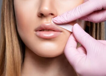 Top 5 Benefits of Choosing Professional Epilation Services Over DIY Methods