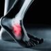 What Causes Foot Fractures and How a Huntsville Foot Doctor Can Help